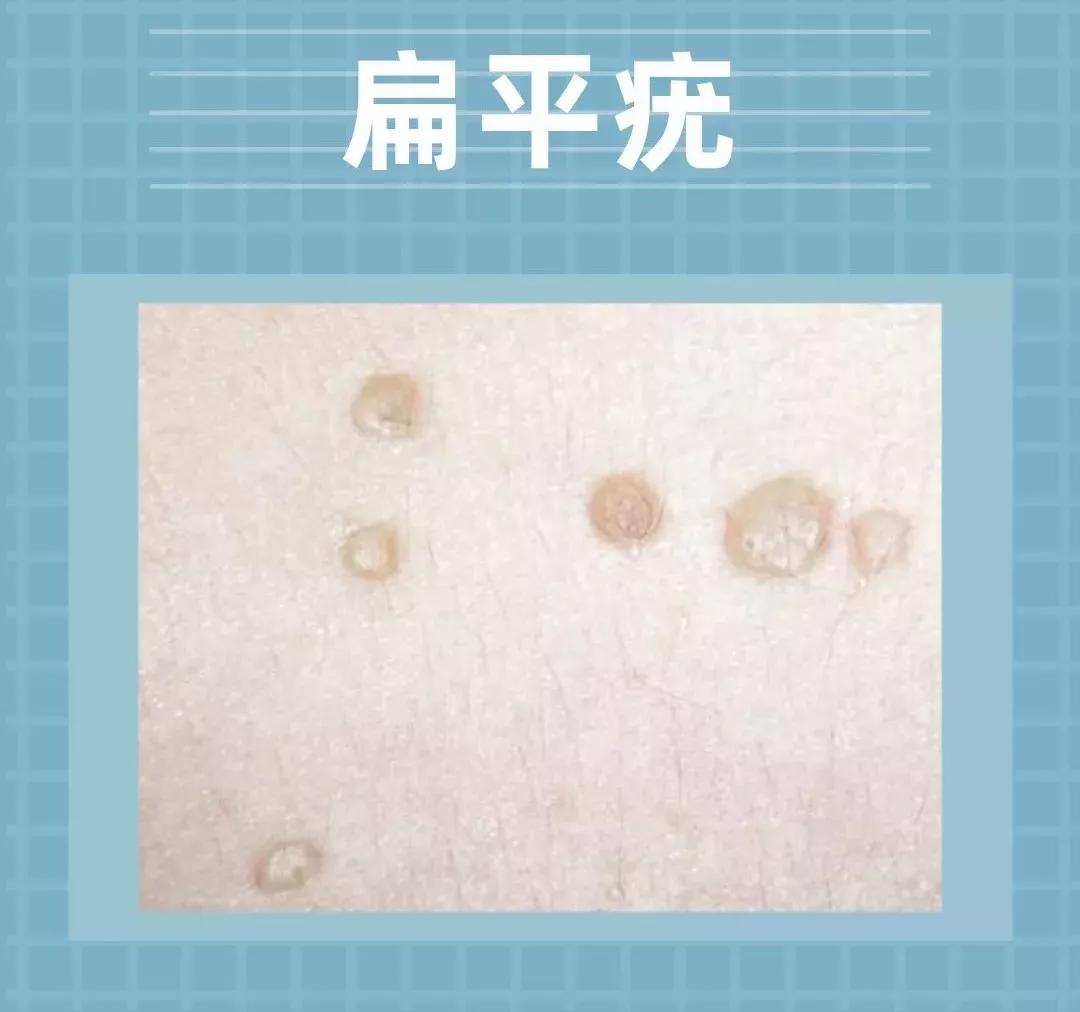 a6ac70480a0c2659eed99660ad4ab7ac_7aaa13c61b914d65b38e2ee0b85cc74c.JPG